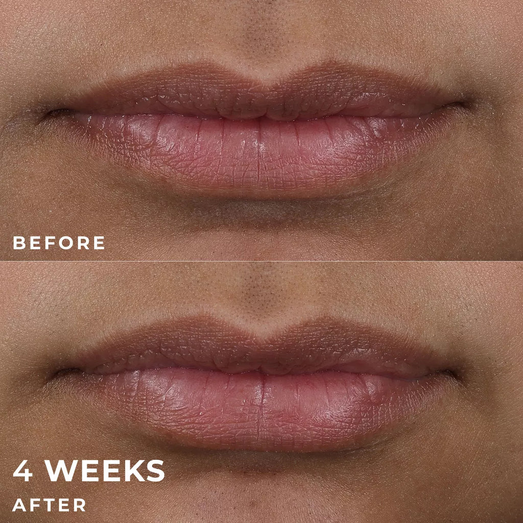Roc Derm Correxion Lip Volumizer Treatment - 0.34 Fl Oz: Clear, Contains Peptides, Contains Hyaluronic Acid