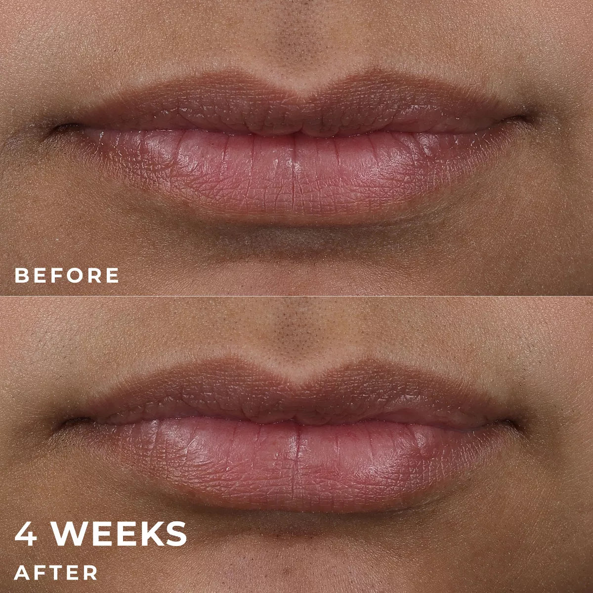 Roc Derm Correxion Lip Volumizer Treatment - 0.34 Fl Oz: Clear, Contains Peptides, Contains Hyaluronic Acid