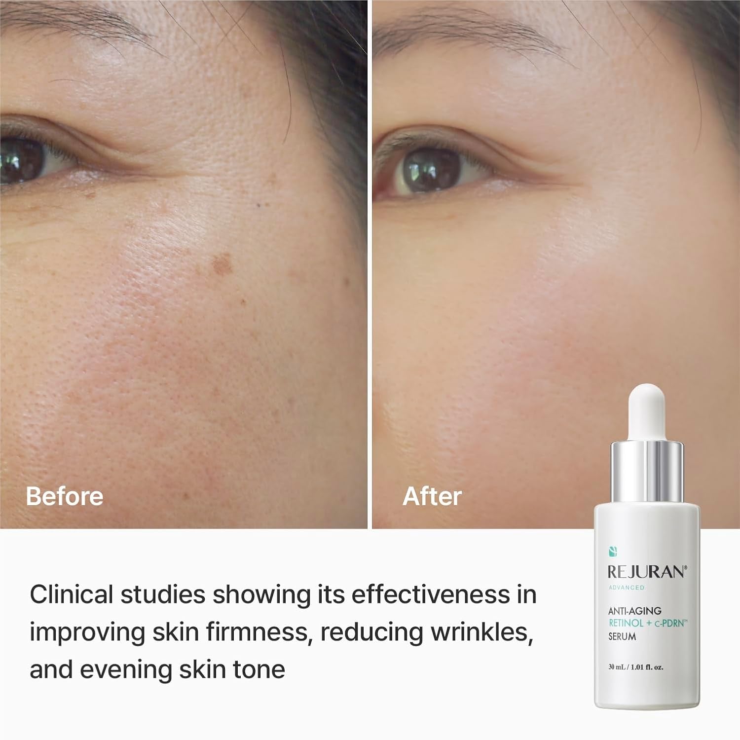 ® Advanced Anti-Aging Retinol + C-Pdrn® Serum - Boosting Facial Serum for Firmness, Radiance and Anti-Wrinkle Care, Clinically Developed (1.01 Fl Oz)