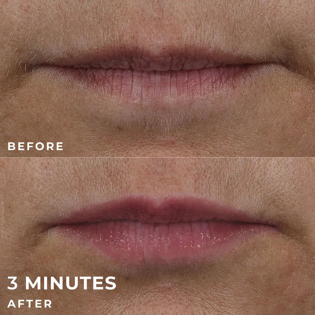 Roc Derm Correxion Lip Volumizer Treatment - 0.34 Fl Oz: Clear, Contains Peptides, Contains Hyaluronic Acid