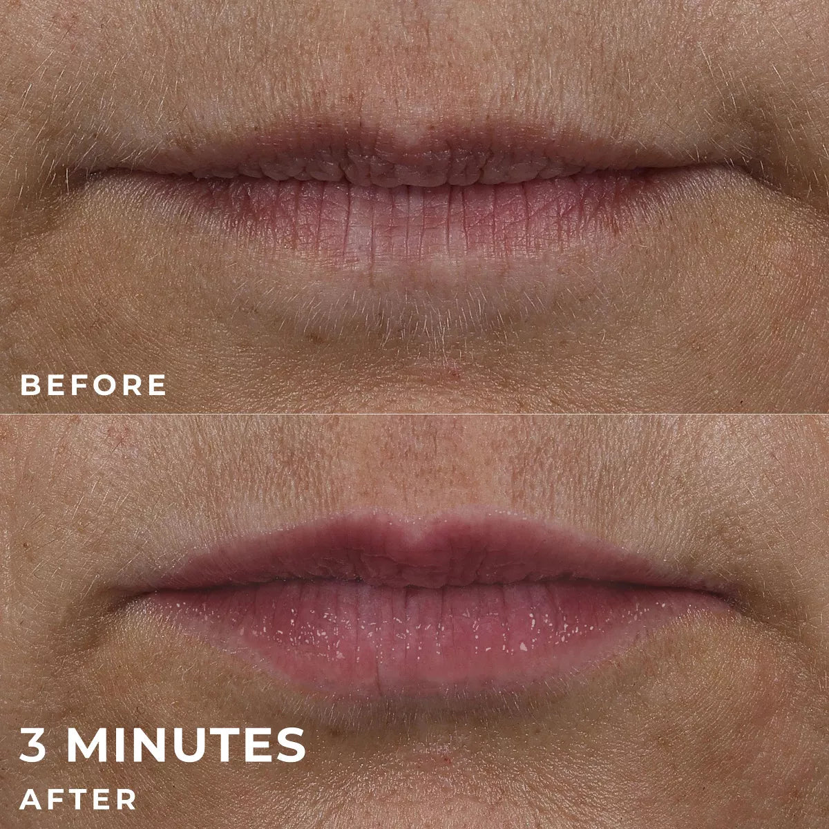 Roc Derm Correxion Lip Volumizer Treatment - 0.34 Fl Oz: Clear, Contains Peptides, Contains Hyaluronic Acid